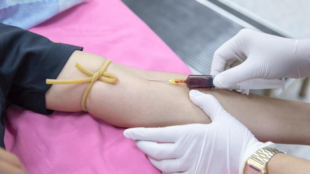 اختبار بسيط للدم ينبئ بالنوبة القلبية قبل عشر سنوات