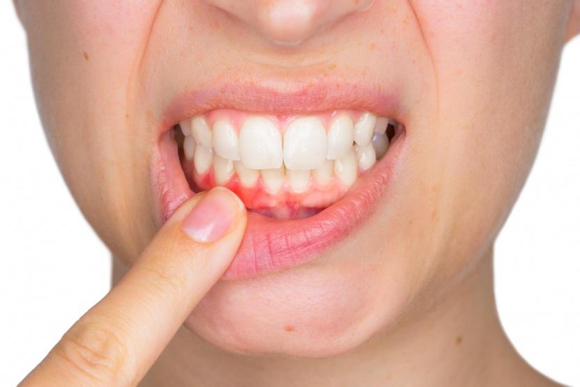 يجب تنظيف طقم الأسنان مرة يوميا على الأقل
