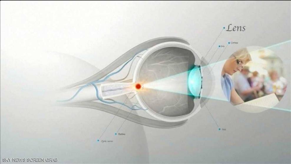 الاستحمام بالعدسات اللاصقة قد يتسبب بفقدان النظر
