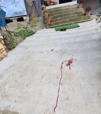 إصابة طفلة في هجوم للمستوطنين جنوب نابلس