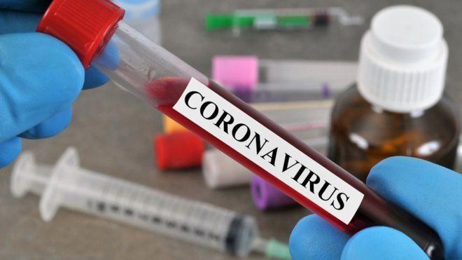 17 وفاة و963 إصابة جديدة بفيروس كورونا و2179 حالة تعاف خلال الـ24 ساعة الأخيرة