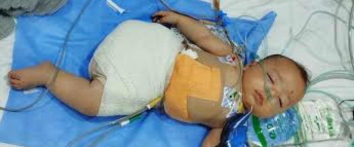 15 ألف مبتور أطرافهم واحتياجات طبية عاجلة في غزة