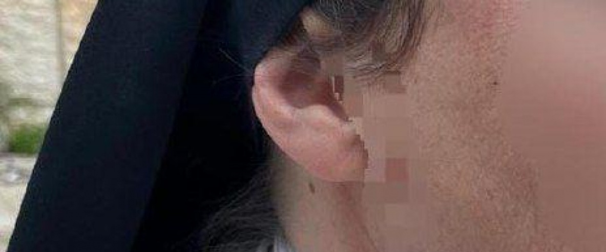 إصابة راهبة باعتداء مستعمر في القدس المحتلة