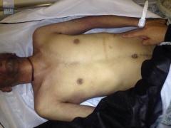 بالصور:- تفاصيل مستوطنون يشنقون سائق فلسطيني بالقدس