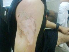 بالصور.. حكم مباراة يكافئ بكوب شاي ساخن