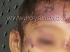 بالصور: آثار الضرب والاعتداء الذي تعرضت له 