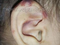 بالصور: آثار الضرب والاعتداء الذي تعرضت له 