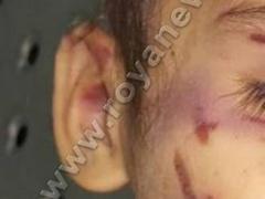 بالصور: آثار الضرب والاعتداء الذي تعرضت له 