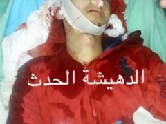 بالصور - شهيدٌ برصاص الاحتلال في مخيم الدهيشة ببيت لحم