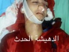 بالصور - شهيدٌ برصاص الاحتلال في مخيم الدهيشة ببيت لحم