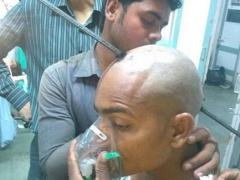 صور- لن تصدّق ما الذي اخترق جمجمة هذا الشاب