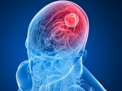 فنّان مصري شهير يكشف عن إصابته بورم في المخ!