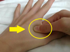 ماذا يحدث عندما تضغط على هذه المنطقة من اليد؟