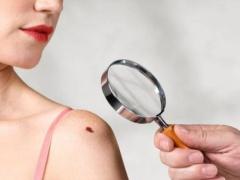 اذا ظهرت عليك بقع سوداء أو بنية فقد تكون إشارة خطيرة جداً!!