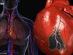 صحة قلبك مرتبطة بمهنتك