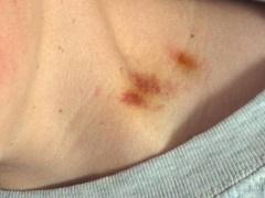 ومن الحب ما قتل...قتلته بقبلة