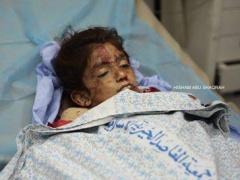 استشهاد طفلة جراء دهسها من قبل مستوطن جنوب بيت لحم