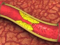 أطعمة لا يجب خلطها مع الادوية