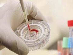 بريطانيون يكتشفون فيروسات قاتلة للرجال فقط