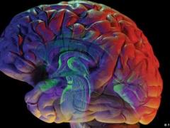 علماء يابانيون يكتشفون آلية لوقف نزيف الدماغ الخطير