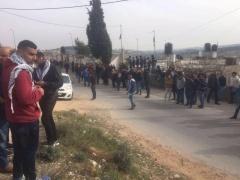 بالصور والفيديو- الصحة: أكثر من 10 رصاصات وشظايا في جسد الشهيد الأعرج