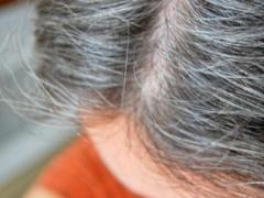 دراسة: الشيب مرتبط بأمراض القلب