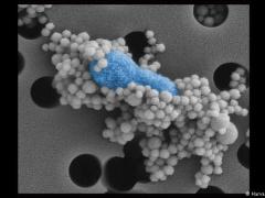 اكتشاف فيروسات عملاقة في مياه الصرف الصحي