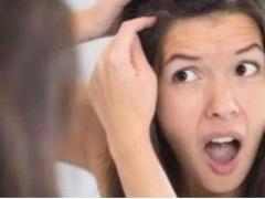 سبب ظهور الشعر الأبيض قبل الثلاثين
