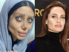 ضعاف القلوب يمتنعون.. فتاة تخضع لـ50 عملية تجميل لتشبه أنجلينا جولي وحدثت الكارثة! (صور)