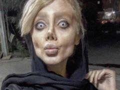 ضعاف القلوب يمتنعون.. فتاة تخضع لـ50 عملية تجميل لتشبه أنجلينا جولي وحدثت الكارثة! (صور)