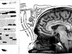 صورة| وثيقة سرية لعلاج السرطان أخفتها المخابرات الأمريكية '34' عامًا !