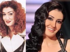 لن تصدّقوا كيف كانت غادة عبد الرازق قبل عمليات التجميل...بالصور