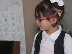 مستشفى جمعية بيت لحم العربية للتأهيل تنفرد وتتميز بتاريخ لقصص نجاح من زراعة القوقعات