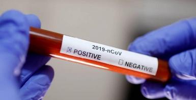 غزة: نتائج 19 حالة مخالطة للمصابين بكورونا 