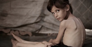 الحصيلة ترتفع لـ 212.. تسجيل 11 حالة وفاة جديدة خلال يوم نتيجة المجاعة