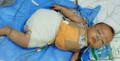 15 ألف مبتور أطرافهم واحتياجات طبية عاجلة في غزة