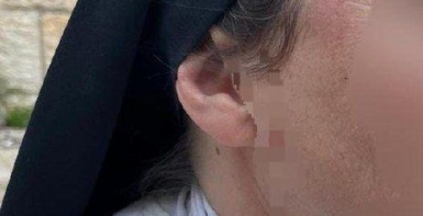 إصابة راهبة باعتداء مستعمر في القدس المحتلة