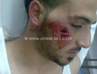 اصابة شاب برصاصة معدنية بوجهه في مواجهات بمخيم عايدة