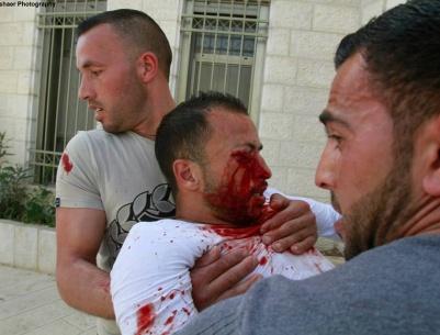 اصابة شاب برصاصة معدنية في عينه خلال مواجهات في بلدة تقوع