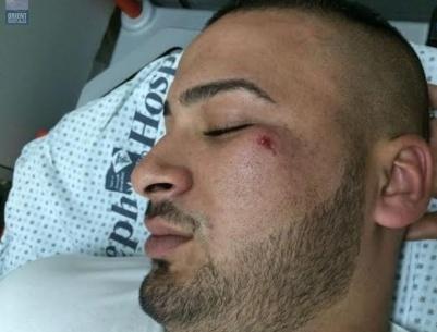 مستوطنون يعتدون على شاب مقدسي بآلة حادة