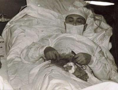 طبيب يجري لنفسه عملية 