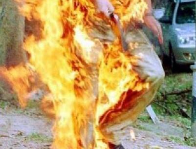 وفاة شاب أضرم النار في نفسه بغزة