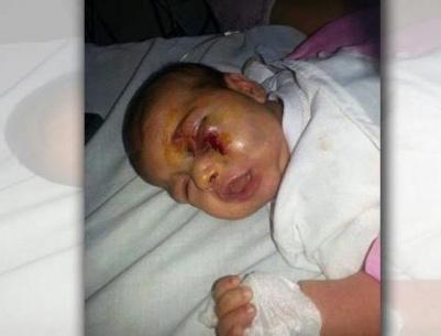 اعتدى على ابنته الرضيعة بشكل وحشي... بسبب بكائها