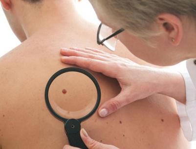 الأطباء يحددون اعراض الأمراض السرطانية التي تستوجب مراجعة الطبيب