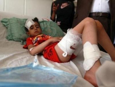 اكثر من 500 طفل قتلوا في اليمن منذ اندلاع النزاع