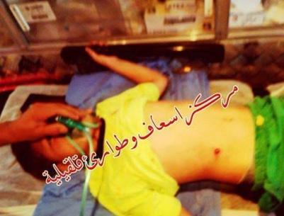 إصابة طفل برصاص مستوطن في قلقيلية