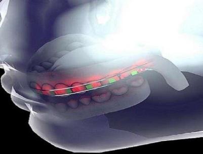 جامعة سعودية تطور تقنية جديدة لتقويم الأسنان