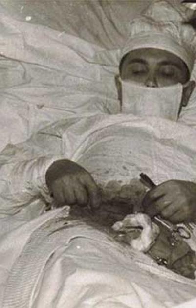 طبيب يجري لنفسه عملية 