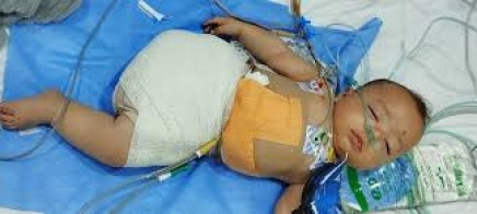 15 ألف مبتور أطرافهم واحتياجات طبية عاجلة في غزة