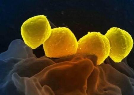 ارتفاع قياسي في الإصابات بعدوى بكتيرية قاتلة في اليابان